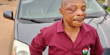 Brutalised NLC President: Labour, oil, electricity workers mobilise for nationwide protest 